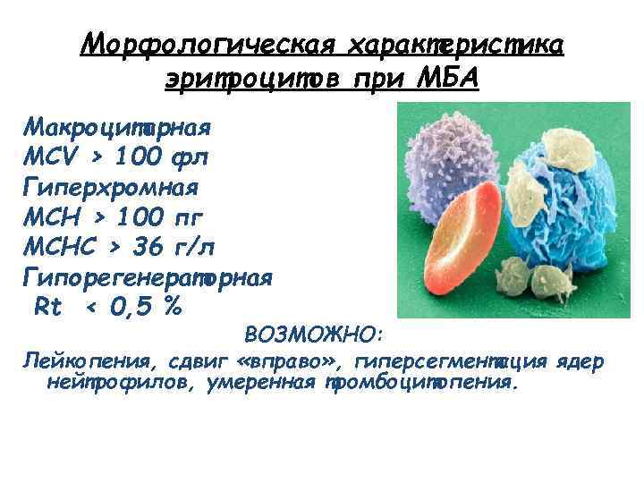 Морфологическая характеристика эритроцитов при МБА Макроцитарная MCV > 100 фл Гиперхромная MCH > 100