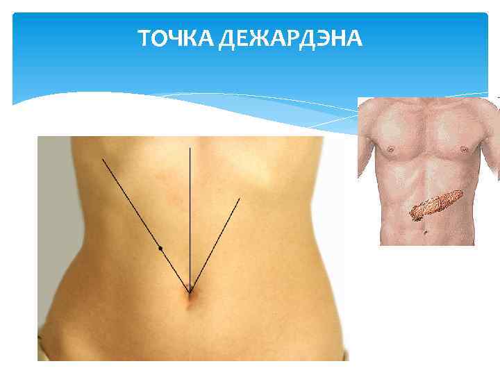 ТОЧКА ДЕЖАРДЭНА 