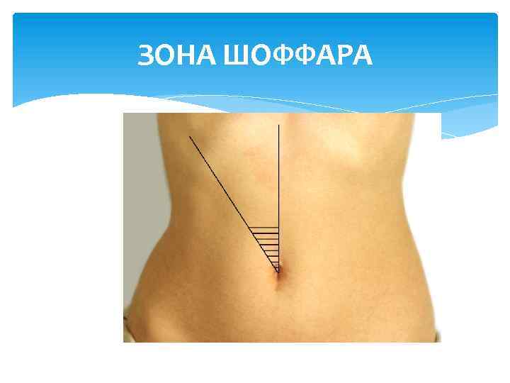 ЗОНА ШОФФАРА 