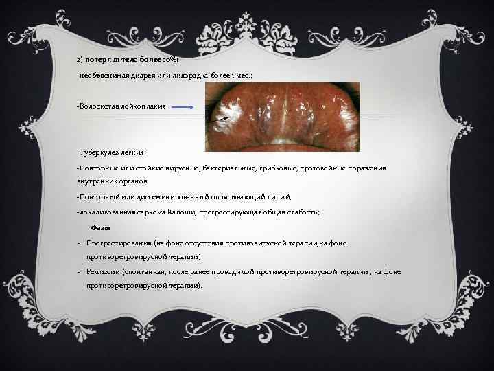 2) потеря m тела более 10%: -необъяснимая диарея или лихорадка более 1 мес. ;