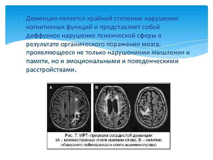  Деменция является крайней степенью нарушения когнитивных функций и представляет собой диффузное нарушение психической