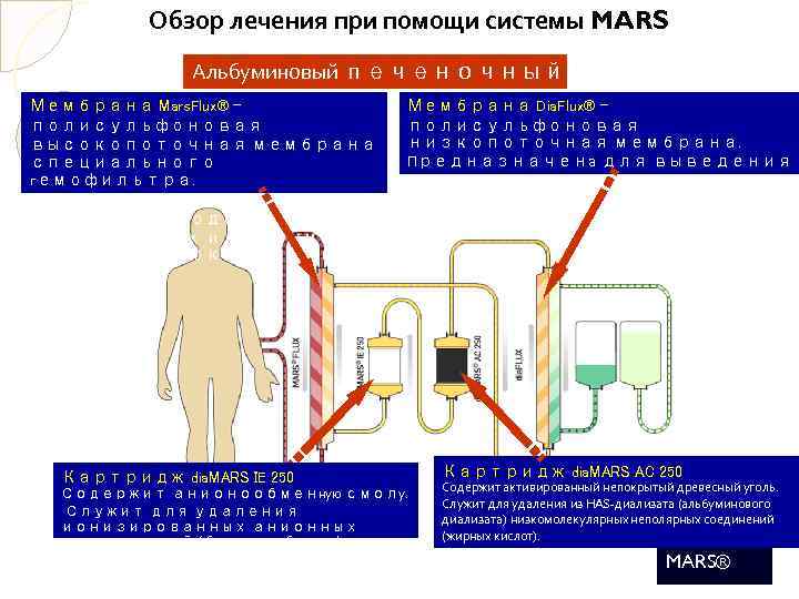 Обзор лечения при помощи системы MARS Альбуминовый печеночный диализ Мембрана Mars. Flux® полисульфоновая высокопоточная