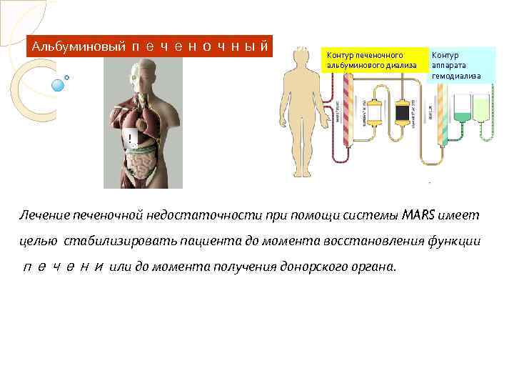 Альбуминовый печеночный диализ Контур печеночного альбуминового диализа Контур аппарата гемодиализа ! Лечение печеночной недостаточности