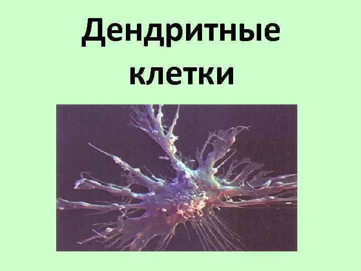 Вакцина дендритными клетками. Дендритные клетки гистология. Дендритные клетки под микроскопом. Дендритная клетка строение и функции. Фолликулярные дендритные клетки.