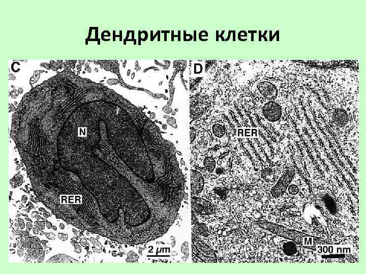 Дендритные клетки 