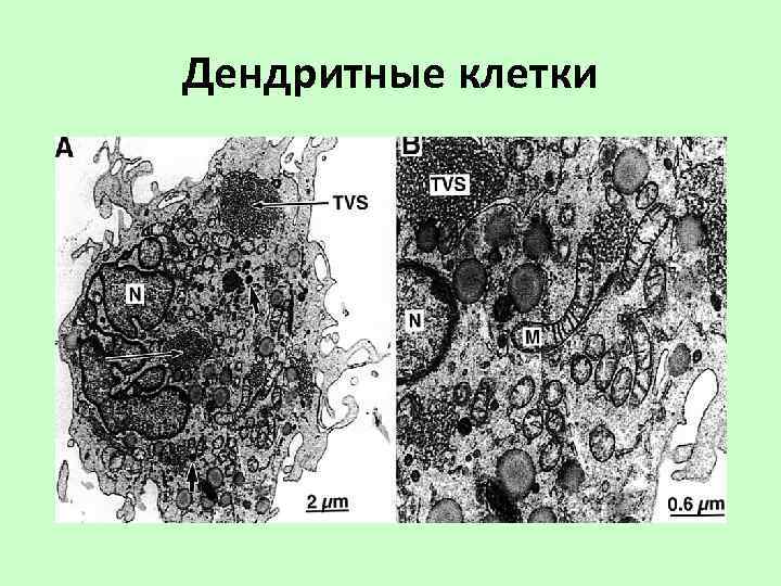 Дендритные клетки 