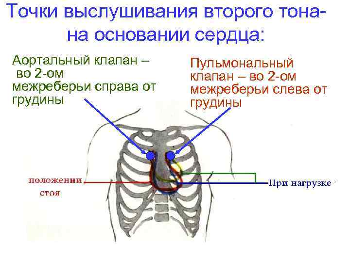 Точка выслушивания аортального клапана