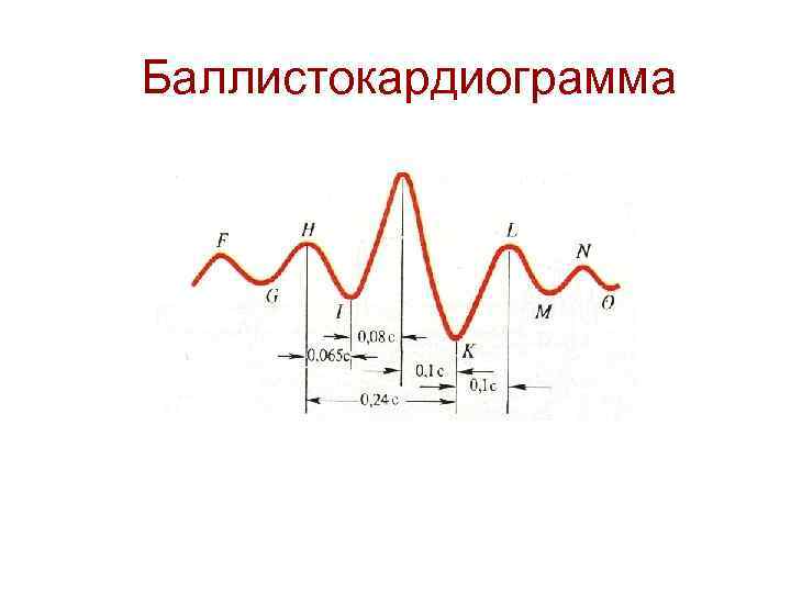 Баллистокардиограмма 