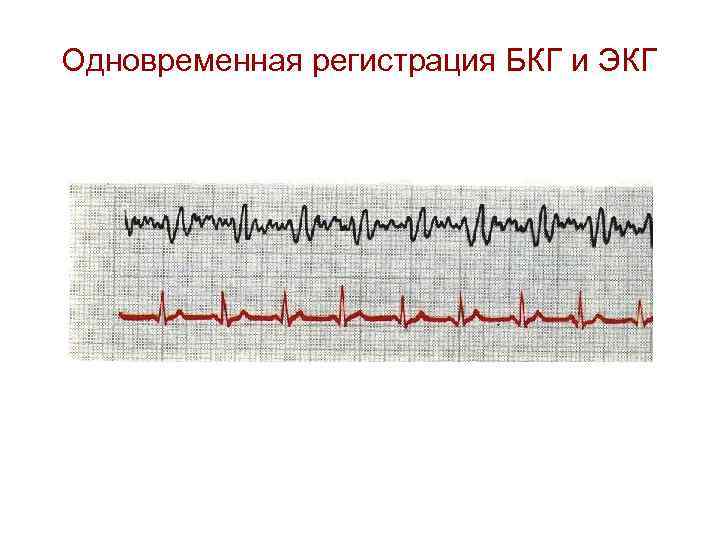 Одновременная регистрация БКГ и ЭКГ 