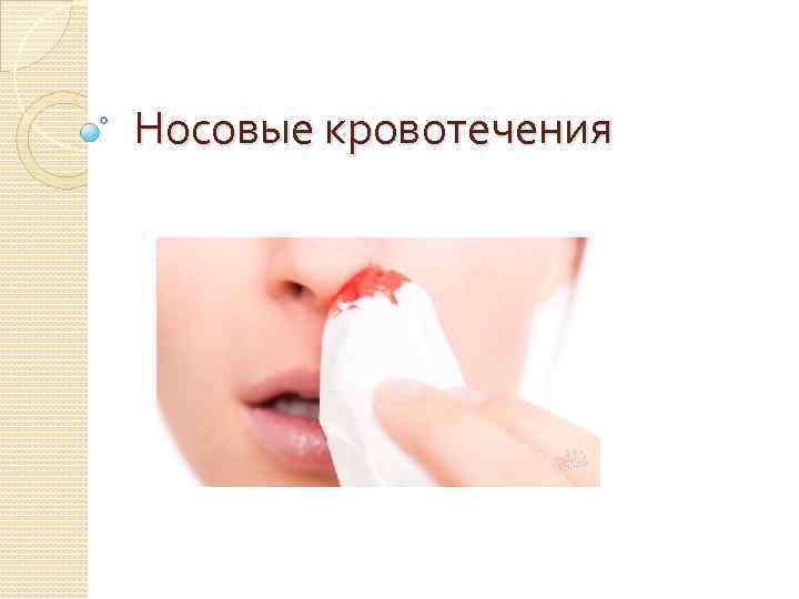 Носовые кровотечения 