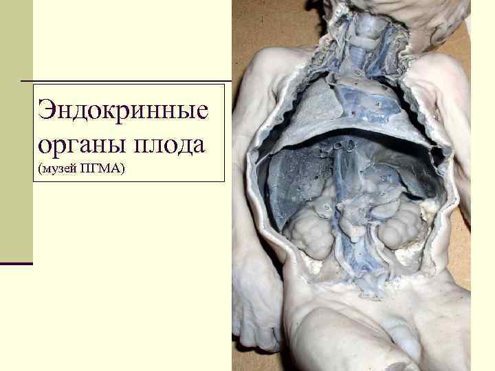 Эндокринные органы плода (музей ПГМА) 