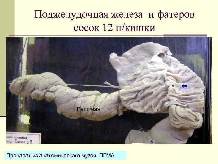 Поджелудочная железа и фатеров сосок 12 п/кишки Pancreas Препарат из анатомического музея ПГМА 