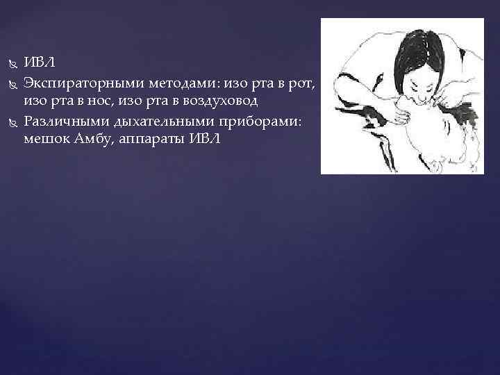  ИВЛ Экспираторными методами: изо рта в рот, изо рта в нос, изо рта