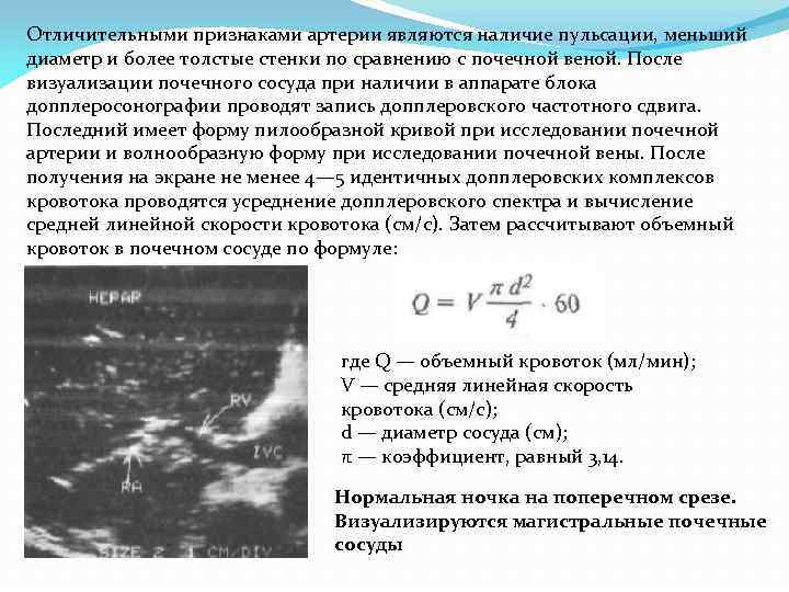 Отличительными признаками артерии являются наличие пульсации, меньший диаметр и более толстые стенки по сравнению