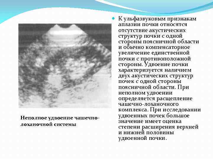 Поликистоз инфильтративного типа мелкокистозного типа дает эхографическую картину