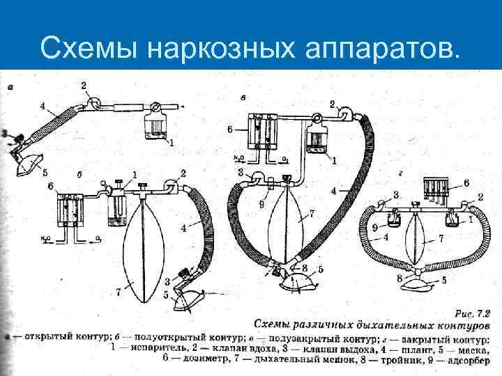 Схема наркозного аппарата