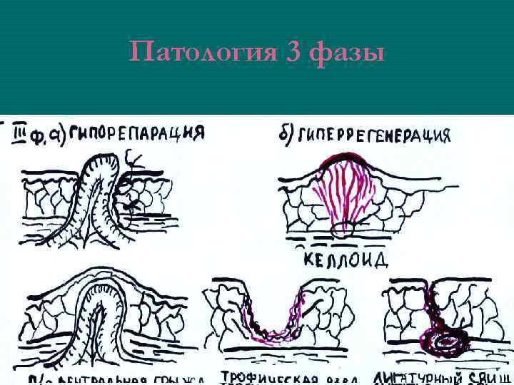 Раневой процесс