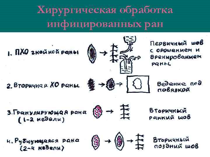 Хирургическая обработка инфицированных ран 