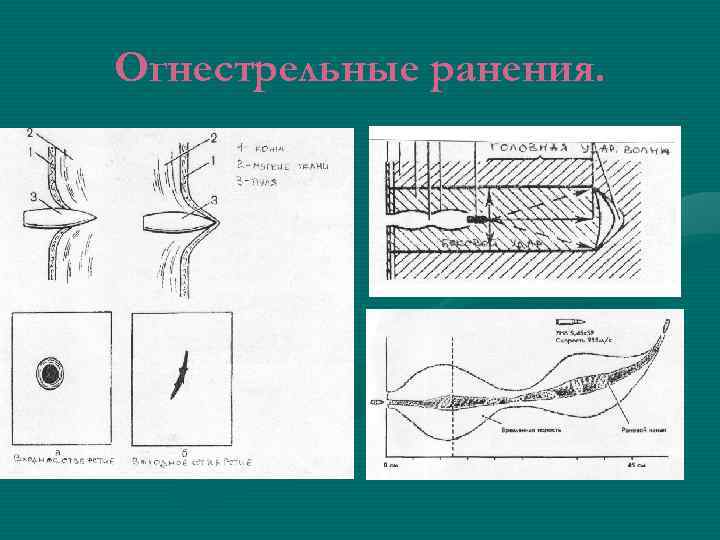 Огнестрельные ранения. 