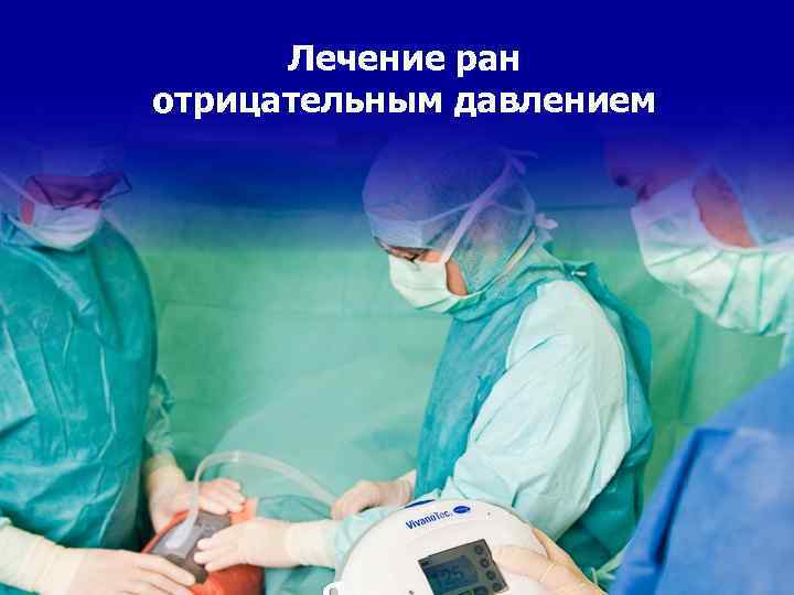 Лечение ран отрицательным давлением 