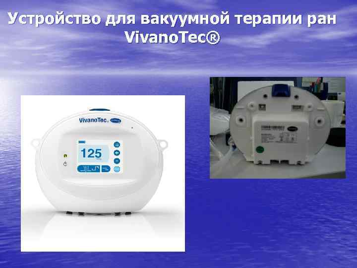 Устройство для вакуумной терапии ран Vivano. Tec® 