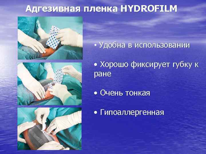 Адгезивная пленка HYDROFILM • Удобна в использовании • Хорошо фиксирует губку к ране •