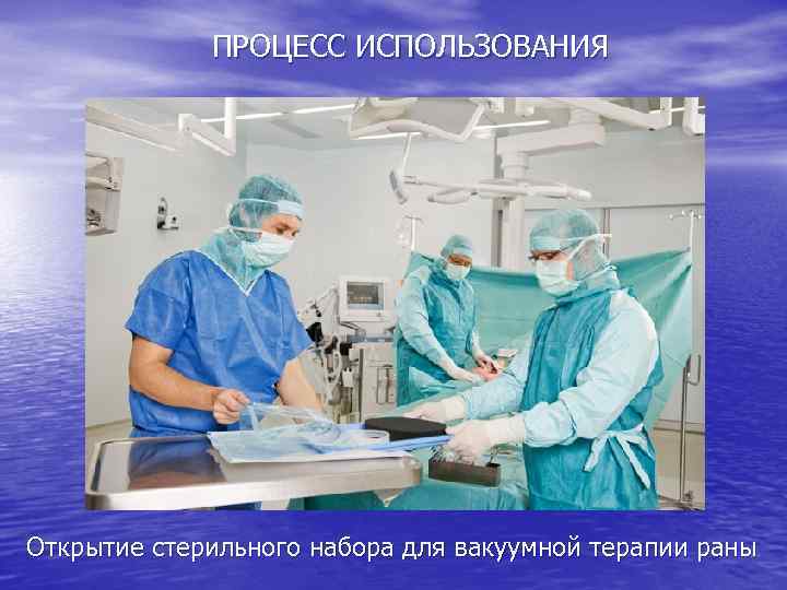 ПРОЦЕСС ИСПОЛЬЗОВАНИЯ Открытие стерильного набора для вакуумной терапии раны 