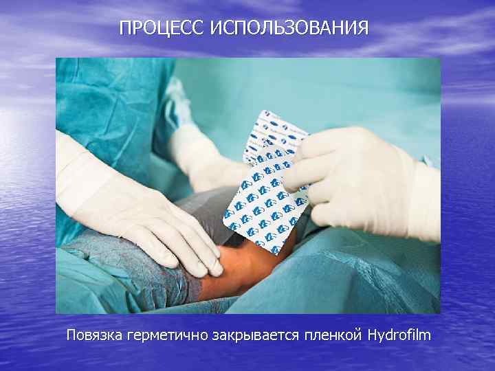 ПРОЦЕСС ИСПОЛЬЗОВАНИЯ Повязка герметично закрывается пленкой Hydrofilm 