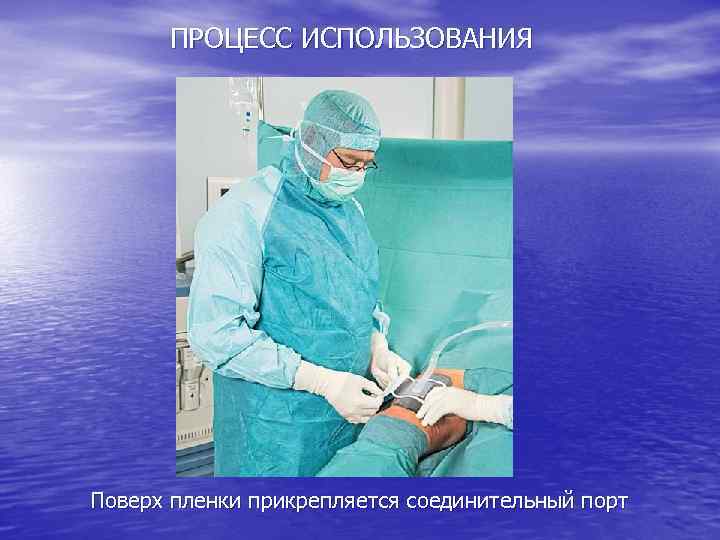 ПРОЦЕСС ИСПОЛЬЗОВАНИЯ Поверх пленки прикрепляется соединительный порт 