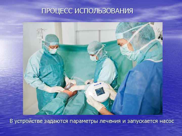 ПРОЦЕСС ИСПОЛЬЗОВАНИЯ В устройстве задаются параметры лечения и запускается насос 