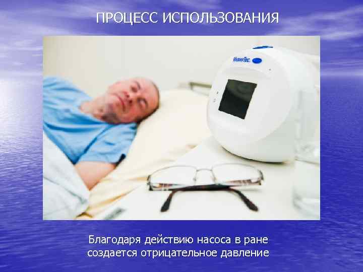 ПРОЦЕСС ИСПОЛЬЗОВАНИЯ Благодаря действию насоса в ране создается отрицательное давление 