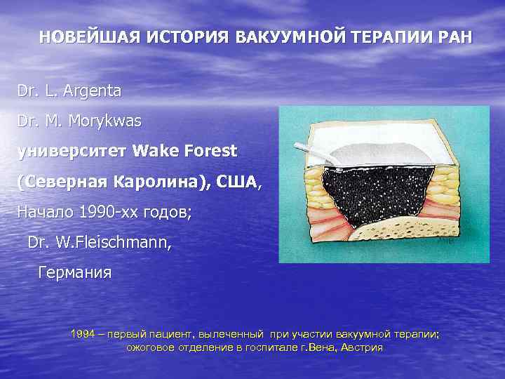 НОВЕЙШАЯ ИСТОРИЯ ВАКУУМНОЙ ТЕРАПИИ РАН Dr. L. Argenta Dr. M. Morykwas университет Wake Forest