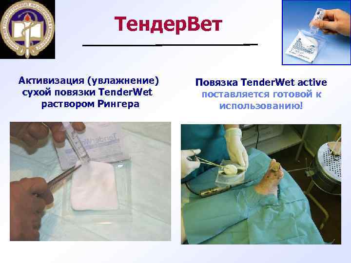 Тендер. Вет Активизация (увлажнение) сухой повязки Tender. Wet раствором Рингера Повязка Tender. Wet active