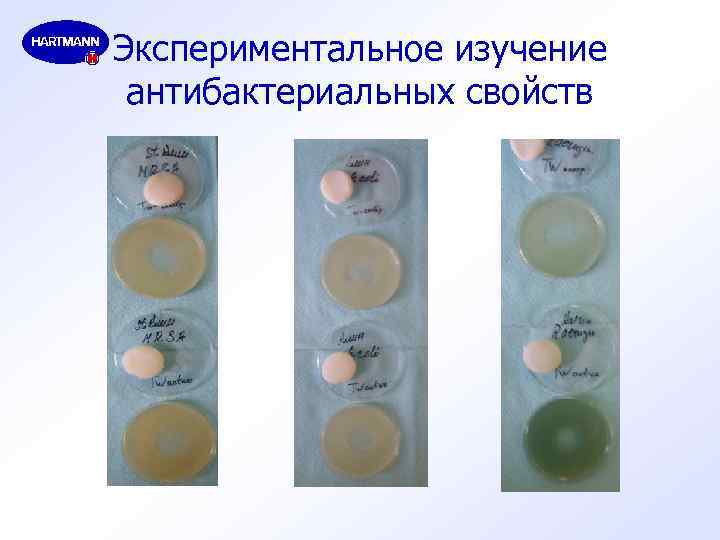 Экспериментальное изучение антибактериальных свойств 
