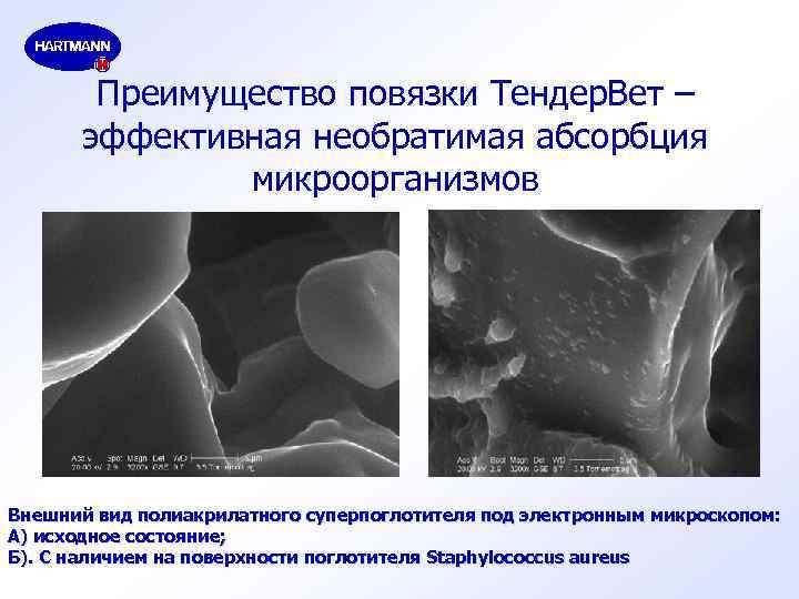 Преимущество повязки Тендер. Вет – эффективная необратимая абсорбция микроорганизмов Внешний вид полиакрилатного суперпоглотителя под