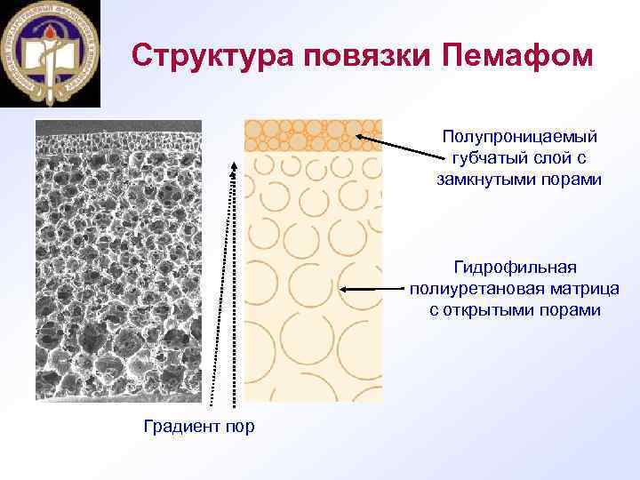 Структура повязки Пемафом Полупроницаемый губчатый слой с замкнутыми порами Гидрофильная полиуретановая матрица с открытыми