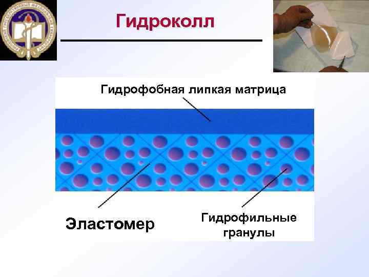 Гидроколл Гидрофобная липкая матрица Эластомер Гидрофильные гранулы 