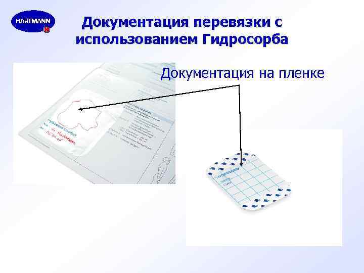 Документация перевязки с использованием Гидросорба Документация на пленке 