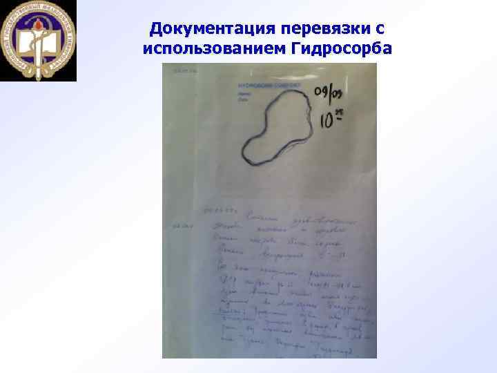 Документация перевязки с использованием Гидросорба 