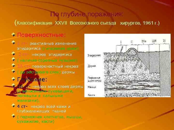 По глубине поражения: (Классификация XXVII Всесоюзного съезда хирургов, 1961 г. ) Поверхностные: 1 ст-