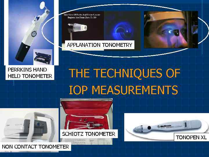  APPLANATION TONOMETRY PERRKINS HAND HELD TONOMETER SCHIOTZ TONOMETER NON CONTACT TONOMETER THE TECHNIQUES