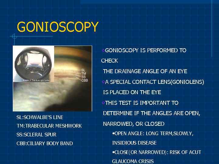 GONIOSCOPY IS PERFORMED TO CHECK THE DRAINAGE ANGLE OF AN EYE A SPECIAL CONTACT