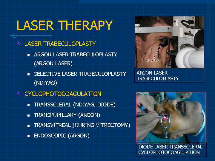 LASER THERAPY LASER TRABECULOPLASTY n ARGON LASER TRABECULOPLASTY (ARGON LASER) n SELECTIVE LASER TRABECULOPLASTY