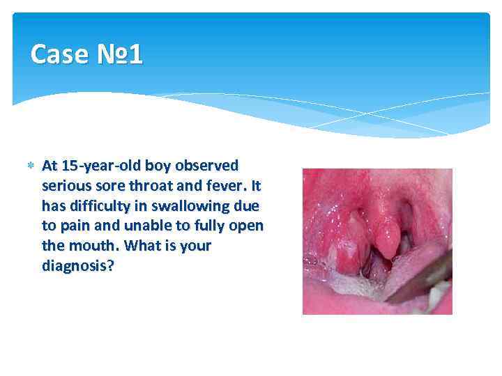 Case № 1 At 15 -year-old boy observed serious sore throat and fever. It