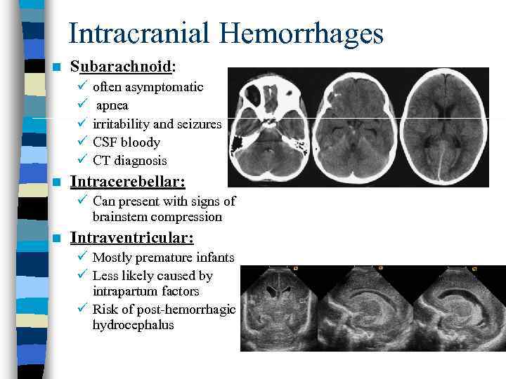 Intracranial Hemorrhages n Subarachnoid: ü ü ü n often asymptomatic apnea irritability and seizures