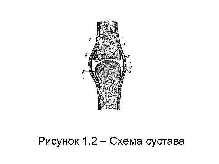 Рисунок 1. 2 – Схема сустава 