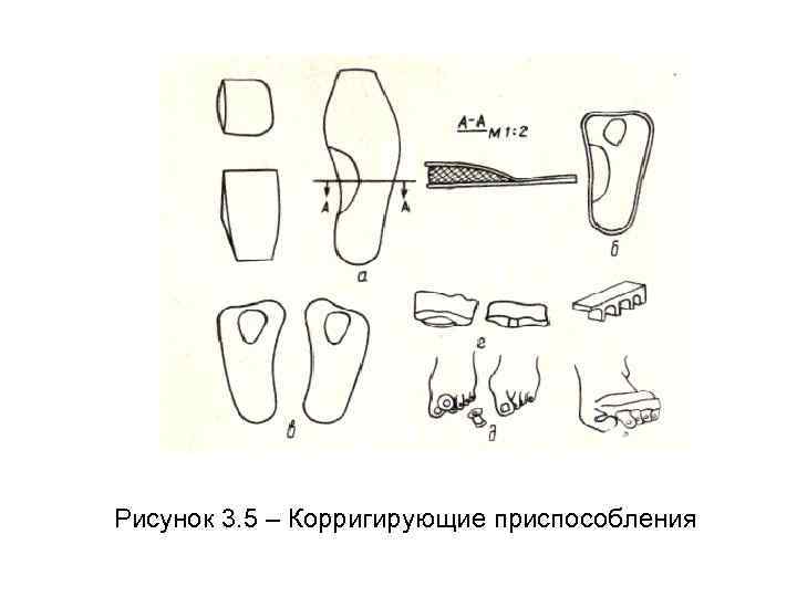 Рисунок 3. 5 – Корригирующие приспособления 