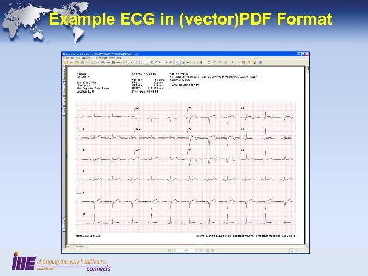 Example ECG in (vector)PDF Format 