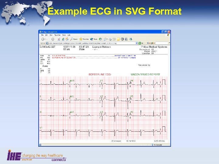 Example ECG in SVG Format 