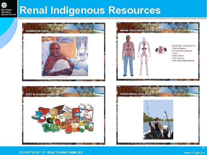 Renal Indigenous Resources 25 
